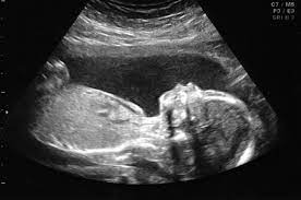 Uncover almost everything that you can do having a fake sonogram in 2022! post thumbnail image